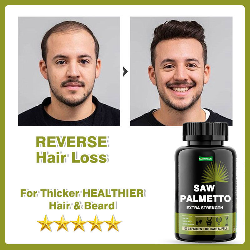 সম্পূরক প্রস্তুতকারক Saw Palmetto Capsules Extra Strength For Reduces Hair Loss
